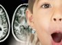 ADHD