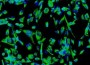 Embyonic Stem Cell