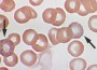 Blood cells
