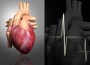 Heart Attack