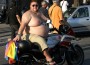 Obesity