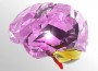 Parkinson's Disease