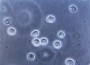 Superbug