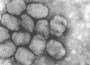 Smallpox