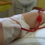 Dialysis Patients