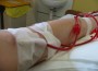 Dialysis Patients