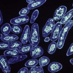 Multidrug-resistant Tuberculosis Feared by Europeans