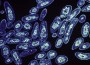 TB Pandemic Resurgence Feared by Europeans