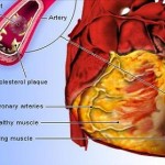 Cardiovascular Diseases Prevented through Balanced Diet — New Study Finds