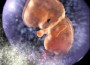 Womb transplant Brings Hope to Women wanting Children