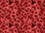 Natural Killer Cells Increase Risk of Miscarriage