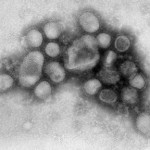 H5N1 Virus may Possibly Kill Half Of The Human Population