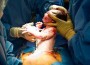 Increased risk of developing asthma by age of 3 after cesarean delivery