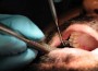 Dentistâ€™s Revenge: Pulls Out Teeth of Ex-boyfriend After Break-up