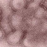 Influenza A Outbreak in Indiana