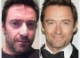 Hugh Jackman Treated For Skin Cancer